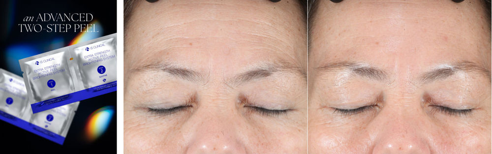 extra-strength-active-peel-brightening-system 